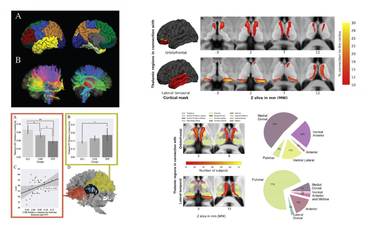 Thalamo-cortical tractography and connectivity-based thalamic segmentation with DKI