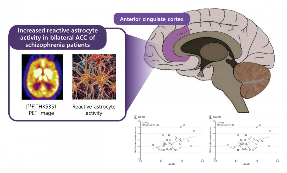 Reactive astrocyte activity in the anterior cingulate cortex in schizophrenia