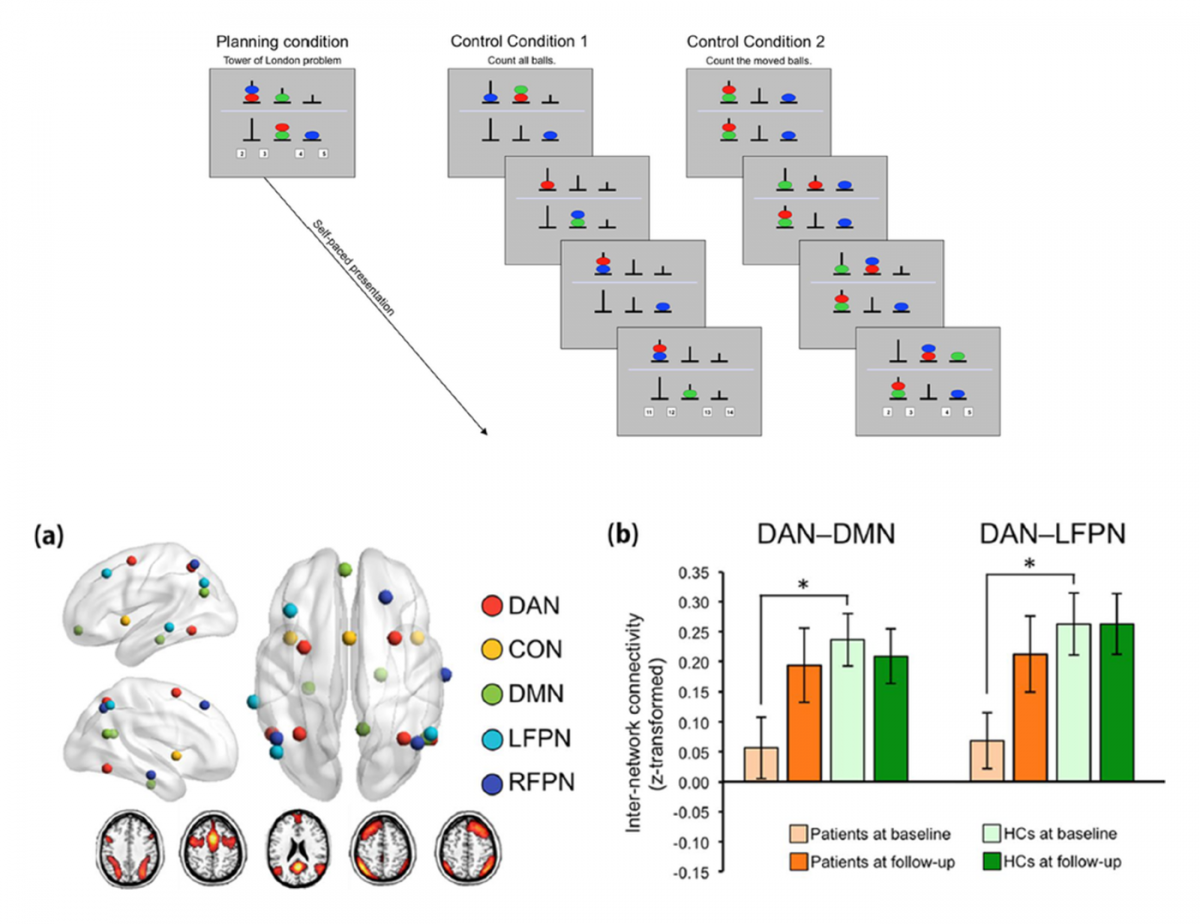 Brain functional network changes during goal-directed planning after SSRI treatment in OCD